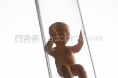 http://wuhan.vdtfzz.com/post/197.html|武汉试管助孕